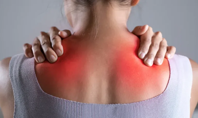 Myofascial Pain