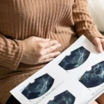 Dysbiosis Weakens