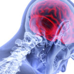 Leaky Brain