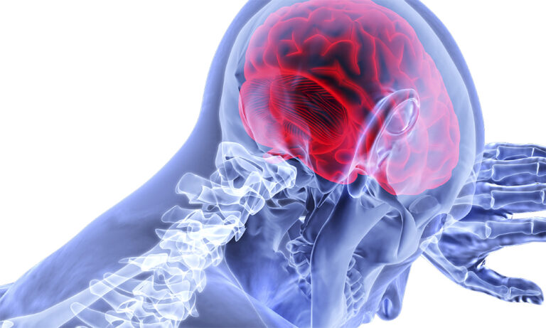 Leaky Brain