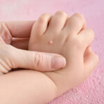 Ways to Get Rid of Warts