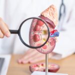 Doctor,With,Kidney,Adrenal,Gland,Anatomy,Model,And,Magnifying,Glass.
