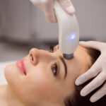 Why Laser Treatments Are Changing Acne Care for All Skin Types