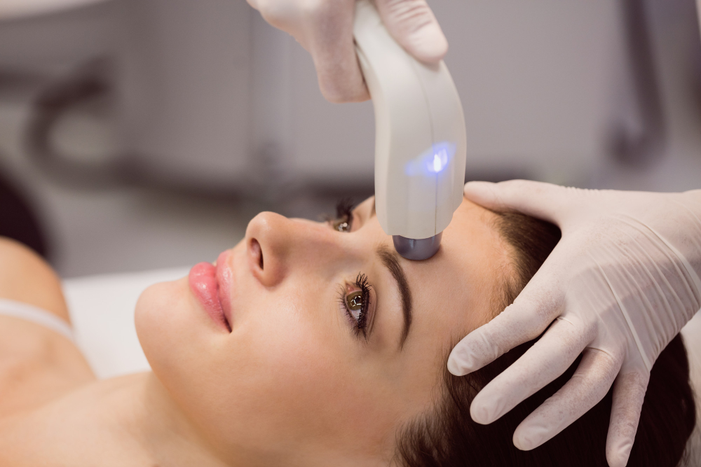 Why Laser Treatments Are Changing Acne Care for All Skin Types